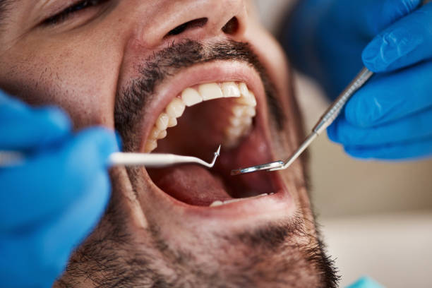 Oral Cancer Screening in Powell, AL
